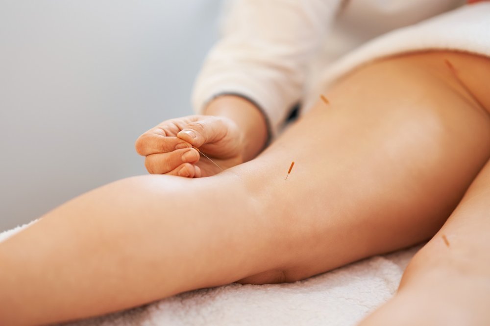 A Acupuncture Needle Therapy In The Studio 2023 11 27 05 20 53 Utc 1 1 1 1 1